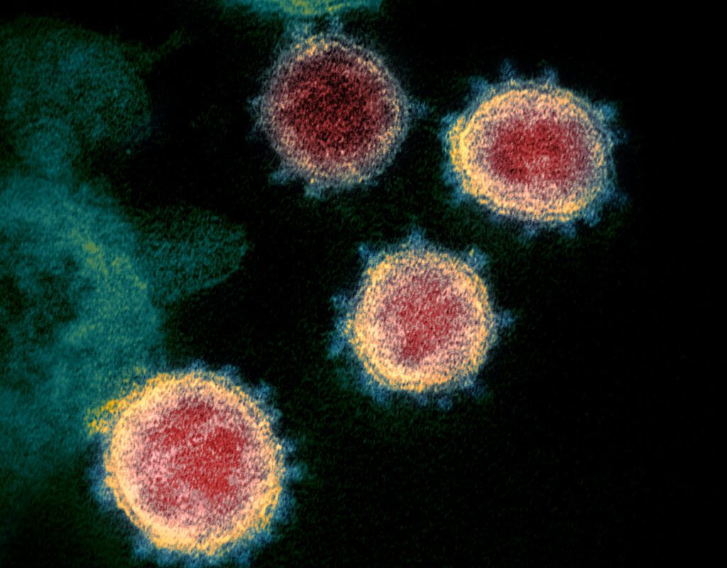 Le temps d’une infection urinaire sans traitement : les facteurs à considérer