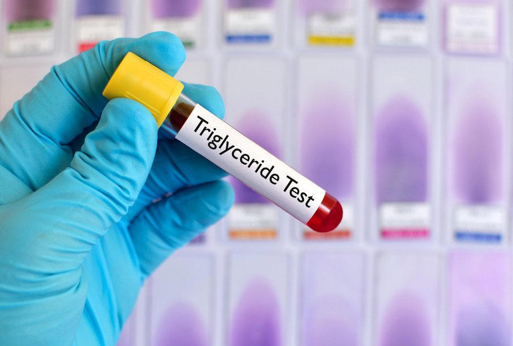 triglycérides test