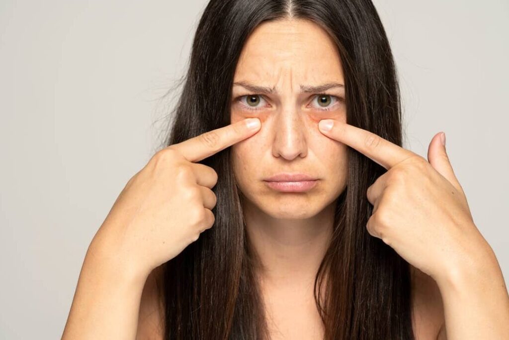 Quel est le lien entre les poches sous les yeux et le foie ?
