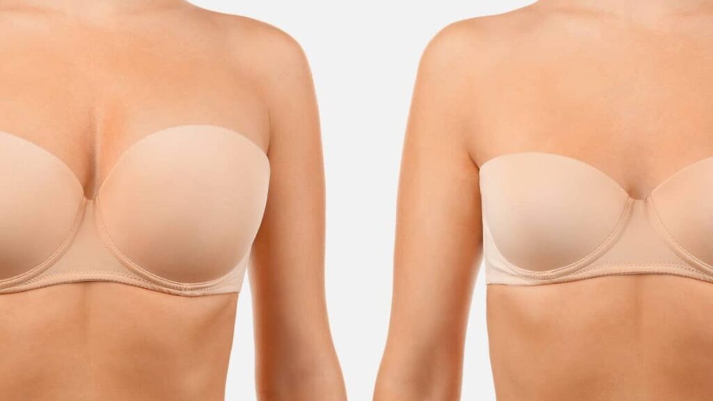 Comment réduire sa poitrine naturellement sans chirurgie ?